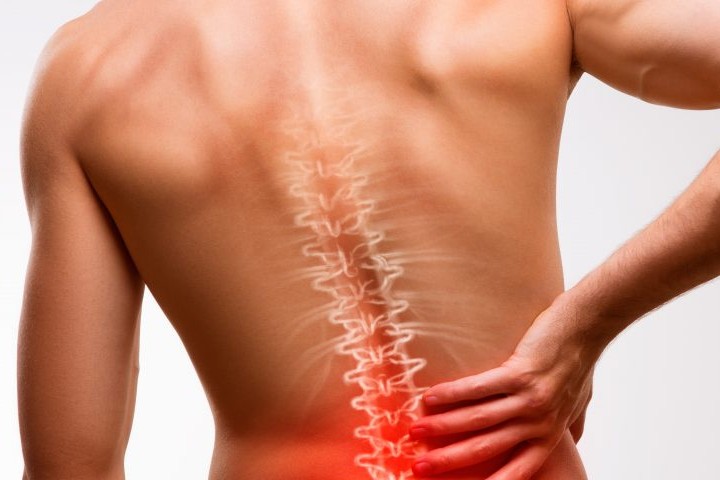 ankylosing-spondylitis-2